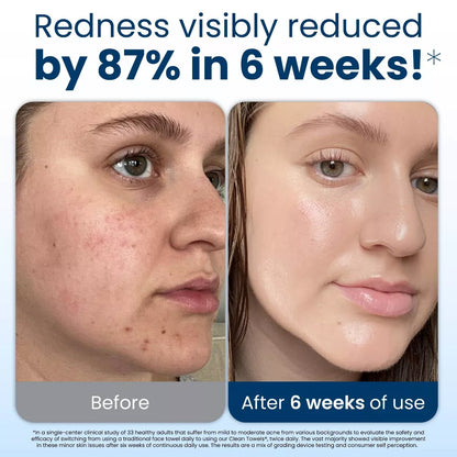 Clean Skin Club Disposable Face Towel for Improved Skin - XL - 50Ct