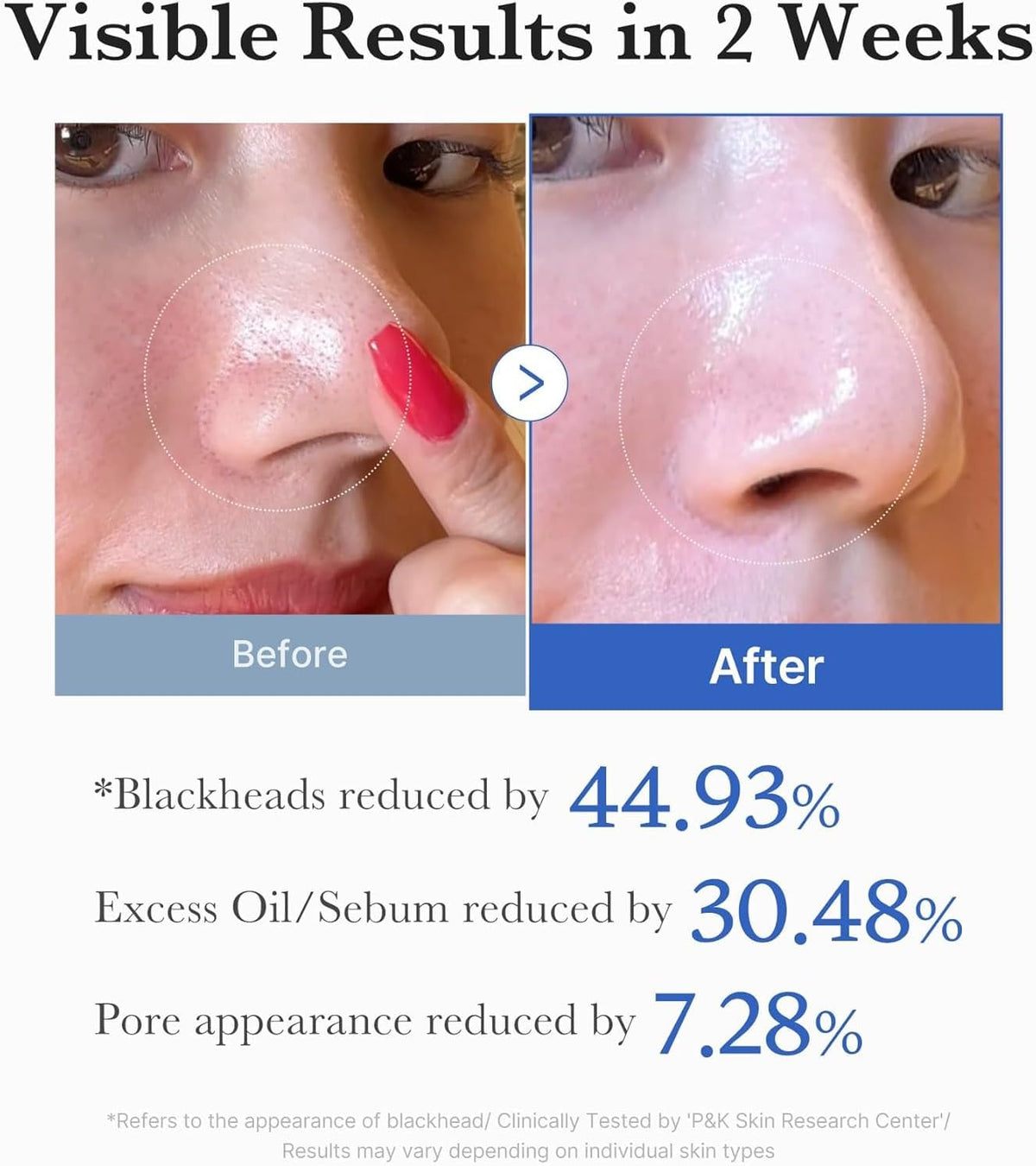 Revitalize Your Skin with Medicube Zero Pore Pads 2.0 - 70 Dual-Textured Facial Toner Pads for Exfoliation and Pore Minimization